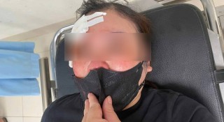 Người phụ nữ 'tố' bị tài xế bán tải hành hung giữa phố ở Hà Nội: Công an vào cuộc xác minh