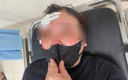 Người phụ nữ 'tố' bị tài xế bán tải hành hung giữa phố ở Hà Nội: Công an vào cuộc xác minh